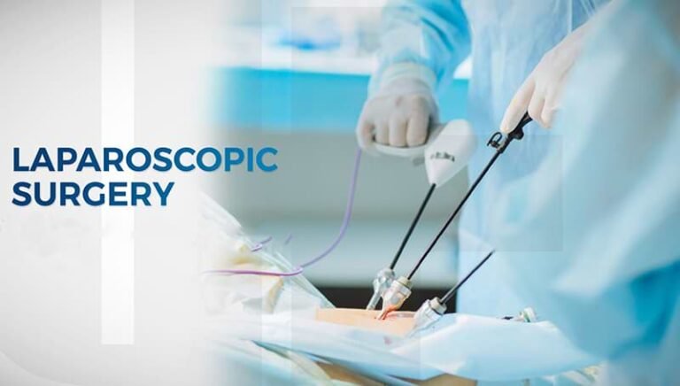 Laparoscopic-Surgery