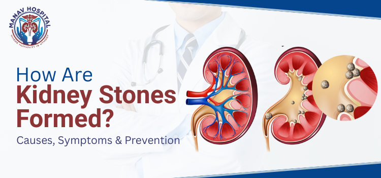 How Are Kidney Stones Formed