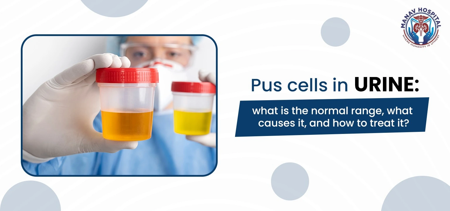 Pus cells in urine: what is the normal range, what causes it, and how to treat it?